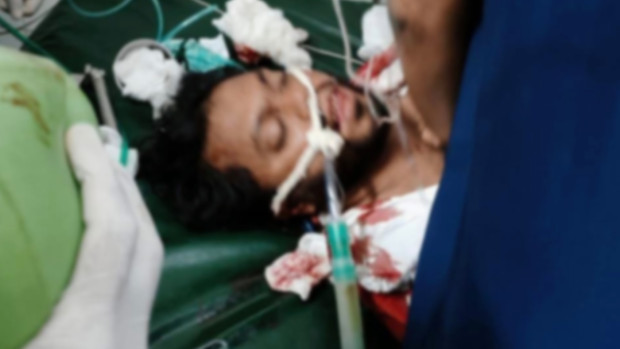 কনজারভেটিভ ম্যানেজমেন্টে রাখা হয়েছে হাদিকে : মেডিকেল বোর্ড