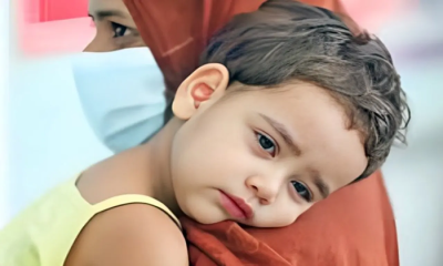 দেশে হাম ও উপসর্গ নিয়ে আরও ১০ শিশুর মৃত্যু