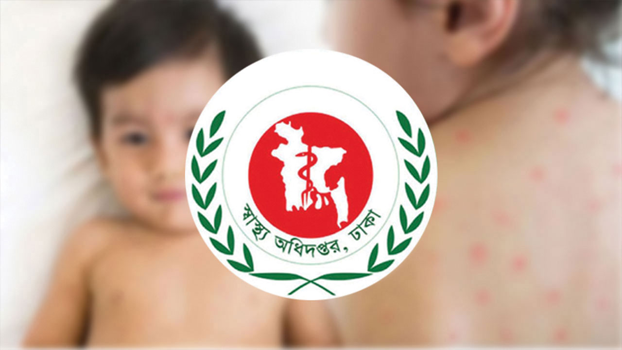 হামের উপসর্গ নিয়ে ২৪ ঘন্টায়  আরও ২ শিশুর মৃত্যু