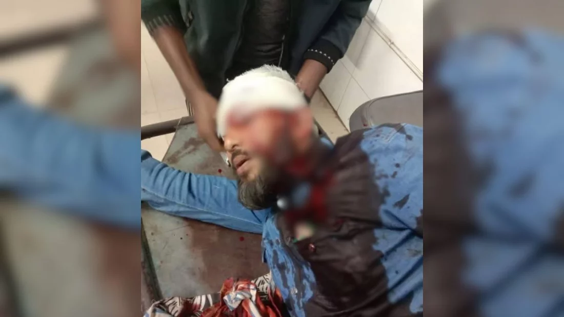 খুলনায় এনসিপি নেতার মাথায় গুলি, অবস্থা আশঙ্কাজনক